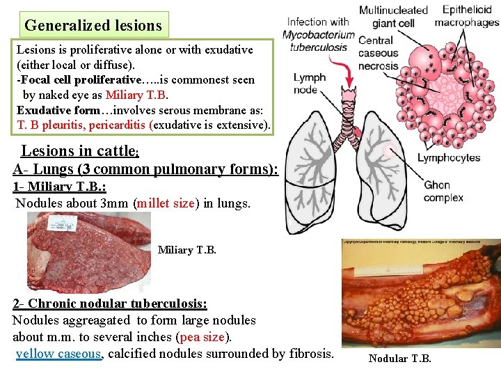 Generalized lesions Lesions is proliferative alone or with exudative (either local or diffuse). -Focal