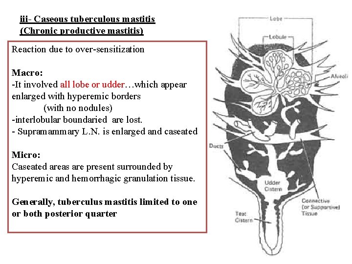iii- Caseous tuberculous mastitis (Chronic productive mastitis) Reaction due to over-sensitization Macro: -It involved