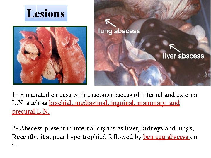 Lesions 1 - Emaciated carcass with caseous abscess of internal and external L. N.