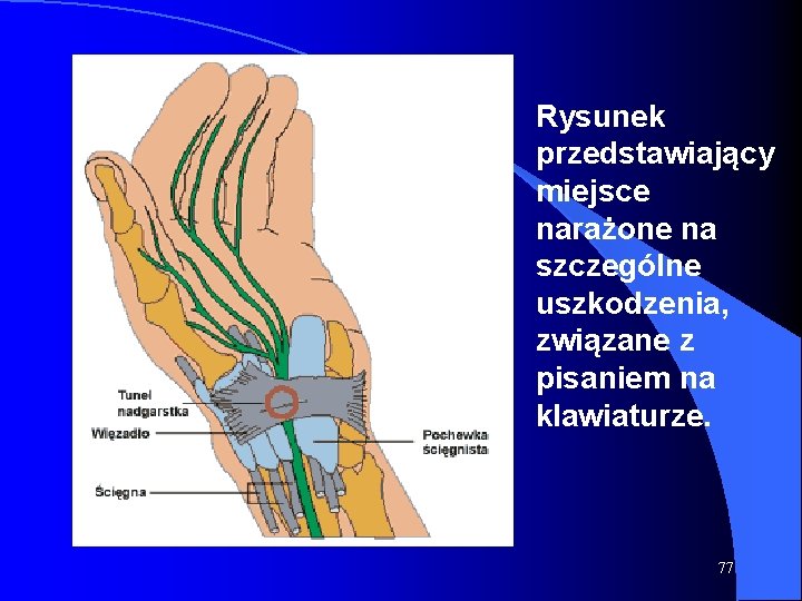 Rysunek przedstawiający miejsce narażone na szczególne uszkodzenia, związane z pisaniem na klawiaturze. 77 