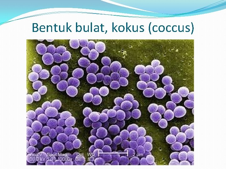 Bentuk bulat, kokus (coccus) 