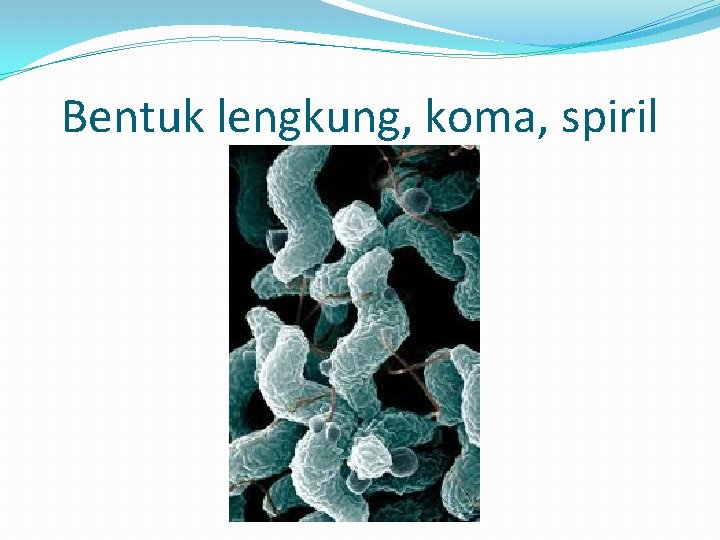 Bentuk lengkung, koma, spiril 