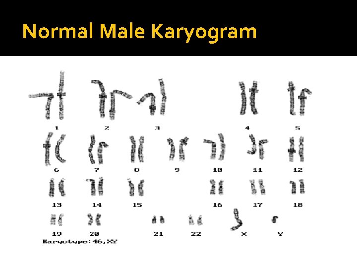 Normal Male Karyogram 