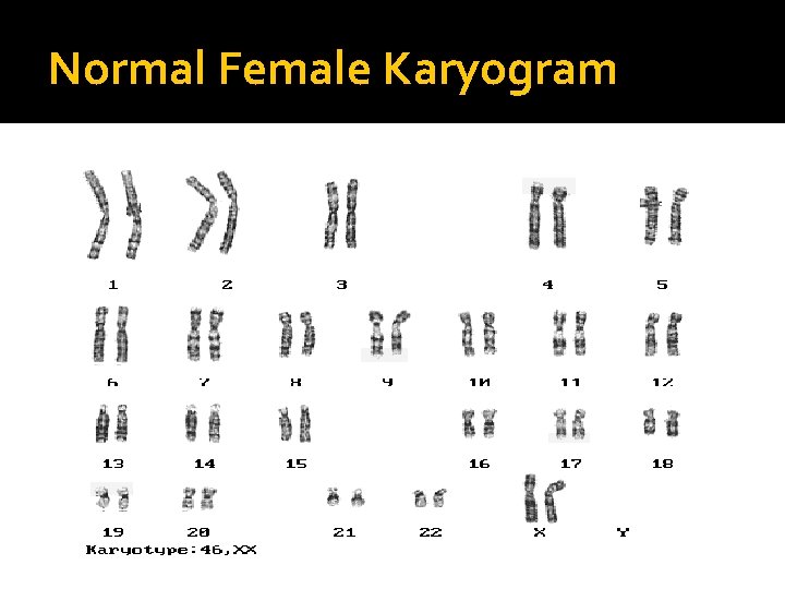 Normal Female Karyogram 