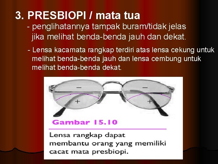 3. PRESBIOPI / mata tua - penglihatannya tampak buram/tidak jelas jika melihat benda-benda jauh