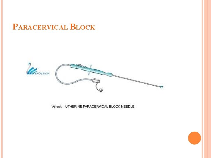 PARACERVICAL BLOCK 