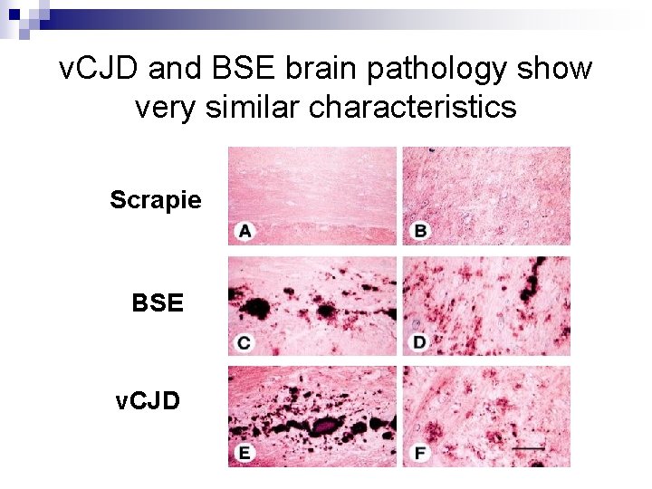 v. CJD and BSE brain pathology show very similar characteristics Scrapie BSE v. CJD