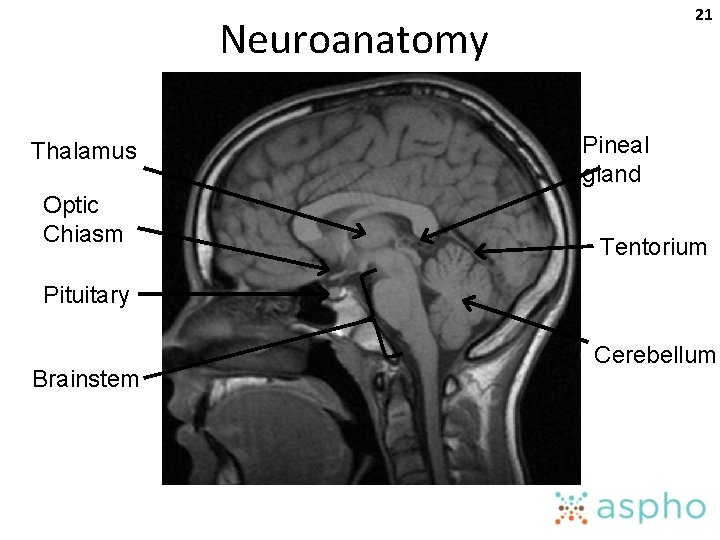 21 Neuroanatomy Thalamus Optic Chiasm Pineal gland Tentorium Pituitary Brainstem Cerebellum 