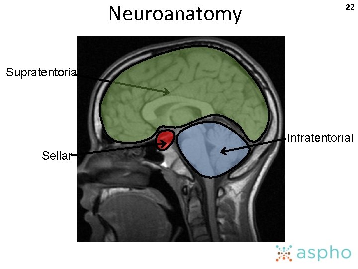 Neuroanatomy 22 Supratentorial Infratentorial Sellar 