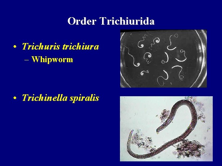 Order Trichiurida • Trichuris trichiura – Whipworm • Trichinella spiralis 