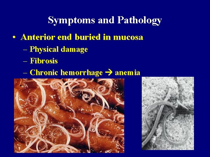 Symptoms and Pathology • Anterior end buried in mucosa – Physical damage – Fibrosis