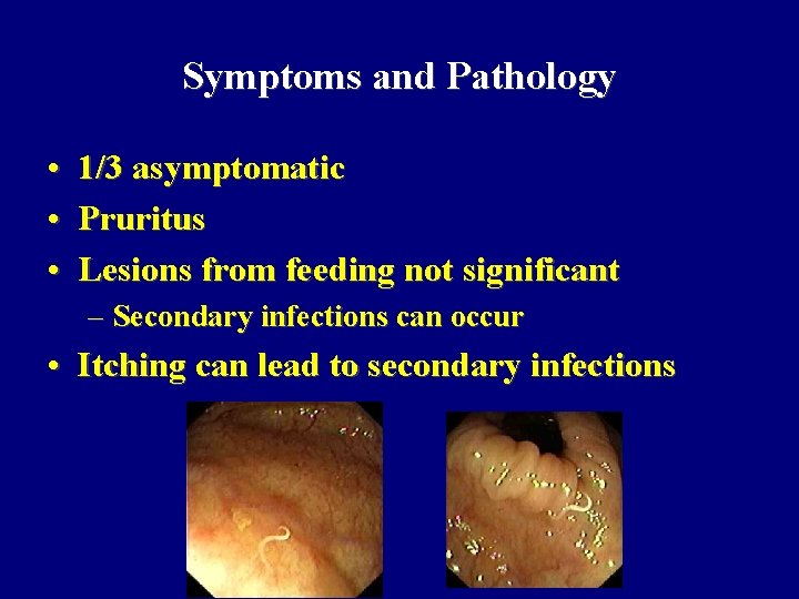 Symptoms and Pathology • 1/3 asymptomatic • Pruritus • Lesions from feeding not significant