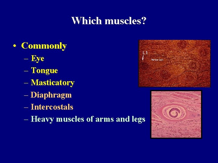 Which muscles? • Commonly – Eye – Tongue – Masticatory – Diaphragm – Intercostals