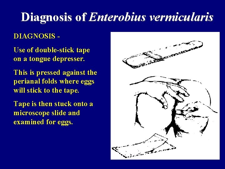 Diagnosis of Enterobius vermicularis DIAGNOSIS Use of double-stick tape on a tongue depresser. This