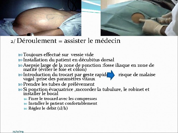 2/ Déroulement = assister le médecin Toujours effectué sur vessie vide Installation du patient