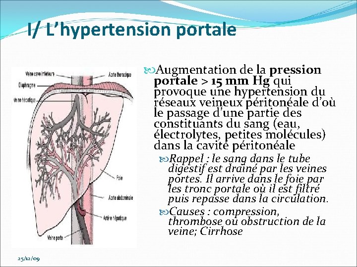 I/ L’hypertension portale Augmentation de la pression portale > 15 mm Hg qui provoque