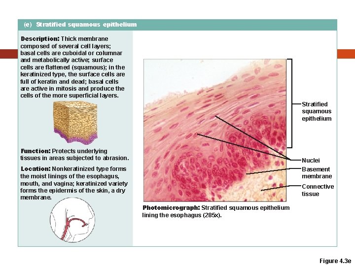 (e) Stratified squamous epithelium Description: Thick membrane composed of several cell layers; basal cells