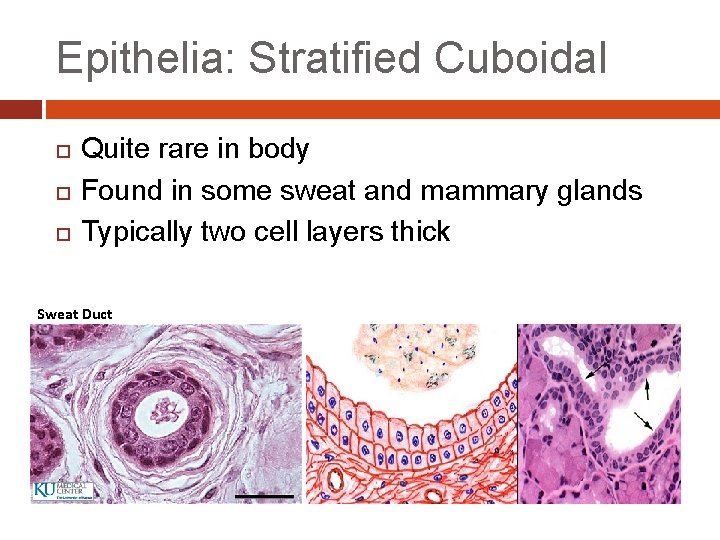 Epithelia: Stratified Cuboidal Quite rare in body Found in some sweat and mammary glands