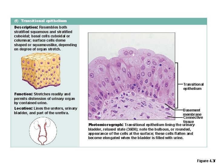 (f) Transitional epithelium Description: Resembles both stratified squamous and stratified cuboidal; basal cells cuboidal