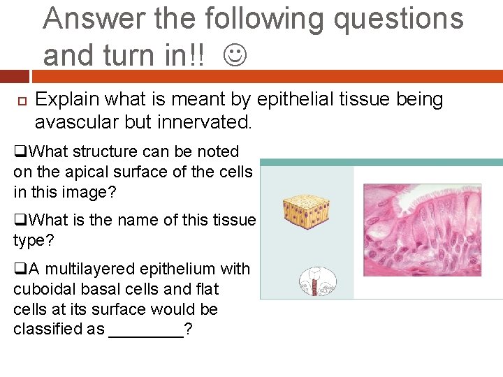 Answer the following questions and turn in!! Explain what is meant by epithelial tissue Answer the following questions and turn in!! Explain what is meant by epithelial tissue