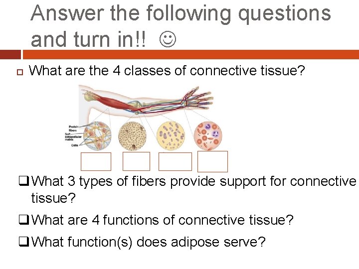 Answer the following questions and turn in!! What are the 4 classes of connective Answer the following questions and turn in!! What are the 4 classes of connective