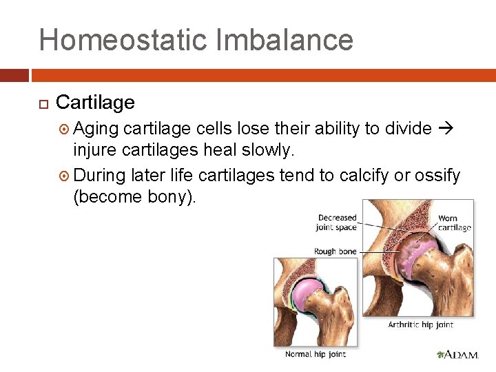 Homeostatic Imbalance Cartilage Aging cartilage cells lose their ability to divide injure cartilages heal