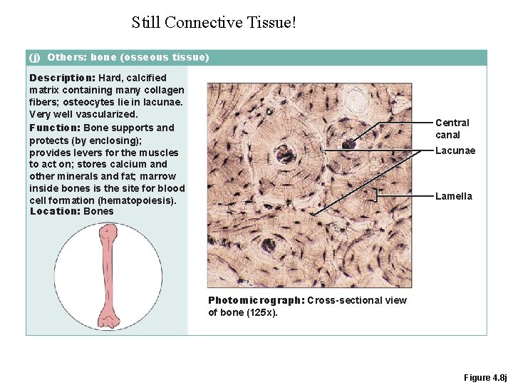 Still Connective Tissue! (j) Others: bone (osseous tissue) Description: Hard, calcified matrix containing many