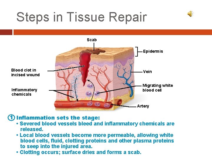 Steps in Tissue Repair Scab Epidermis Blood clot in incised wound Inflammatory chemicals Vein Steps in Tissue Repair Scab Epidermis Blood clot in incised wound Inflammatory chemicals Vein
