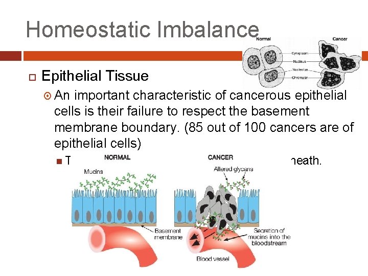 Homeostatic Imbalance Epithelial Tissue An important characteristic of cancerous epithelial cells is their failure