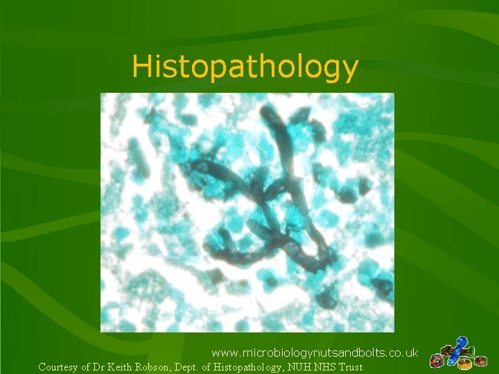 Histopathology www. microbiologynutsandbolts. co. uk Courtesy of Dr Keith Robson, Dept. of Histopathology, NUH