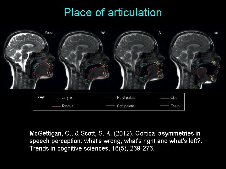 Place of articulation Mc. Gettigan, C. , & Scott, S. K. (2012). Cortical asymmetries