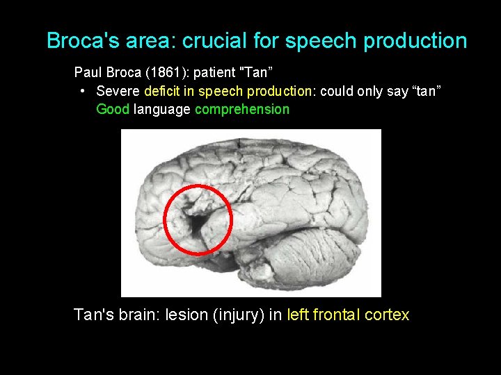 Broca's area: crucial for speech production Paul Broca (1861): patient "Tan” • Severe deficit