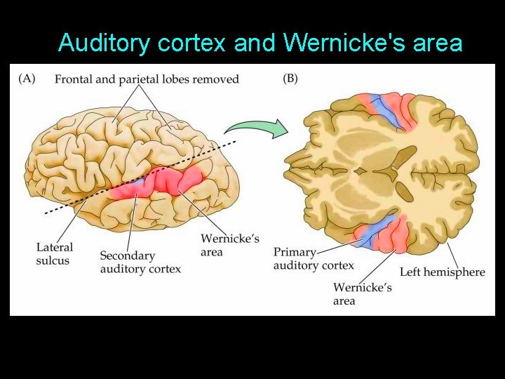 Auditory cortex and Wernicke's area From http: //www. physiology. wisc. edu/neuro 524/ 
