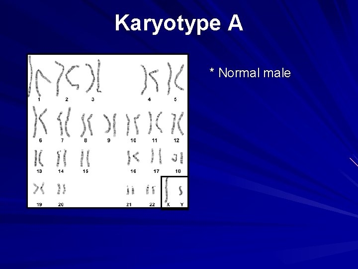 Karyotype A * Normal male 