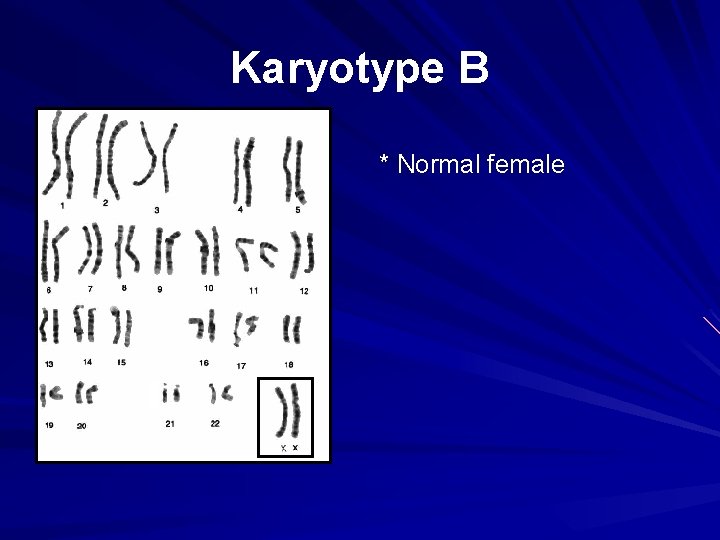 Karyotype B * Normal female 