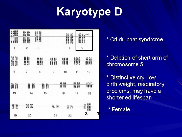 Karyotype D * Cri du chat syndrome * Deletion of short arm of chromosome