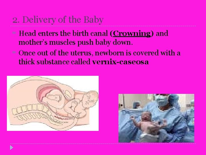 2. Delivery of the Baby Head enters the birth canal (Crowning) and mother’s muscles