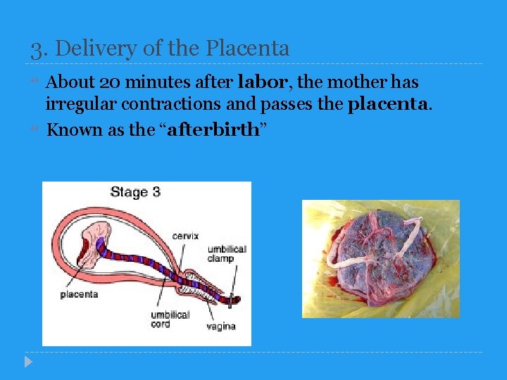 3. Delivery of the Placenta About 20 minutes after labor, the mother has irregular