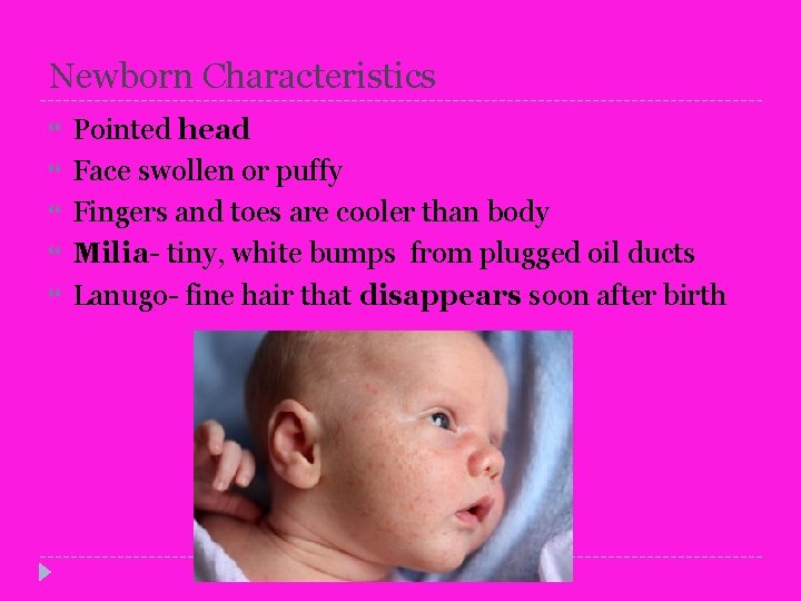 Newborn Characteristics Pointed head Face swollen or puffy Fingers and toes are cooler than
