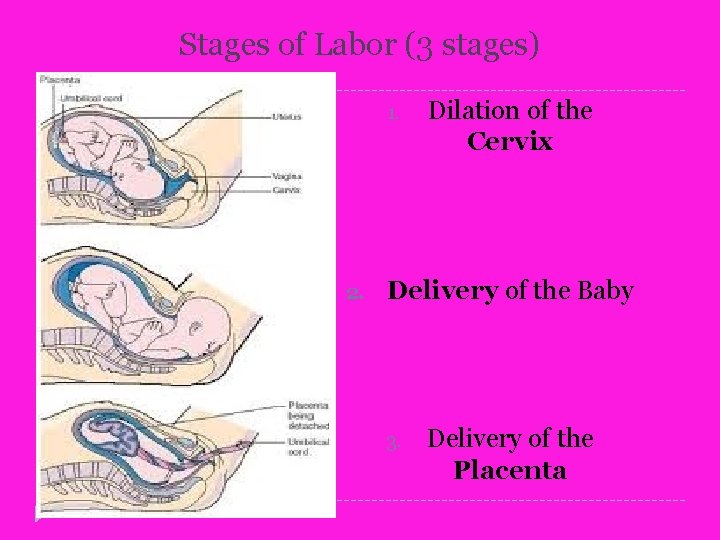 Stages of Labor (3 stages) 1. 2. Dilation of the Cervix Delivery of the