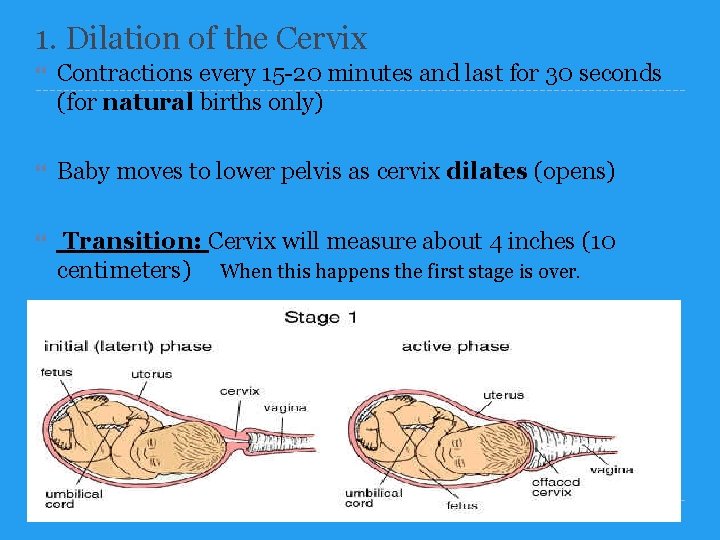 1. Dilation of the Cervix Contractions every 15 -20 minutes and last for 30