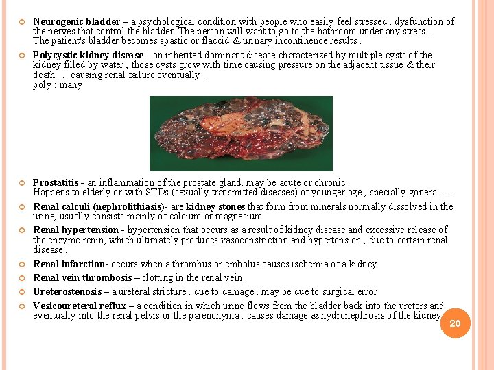  Neurogenic bladder – a psychological condition with people who easily feel stressed ,