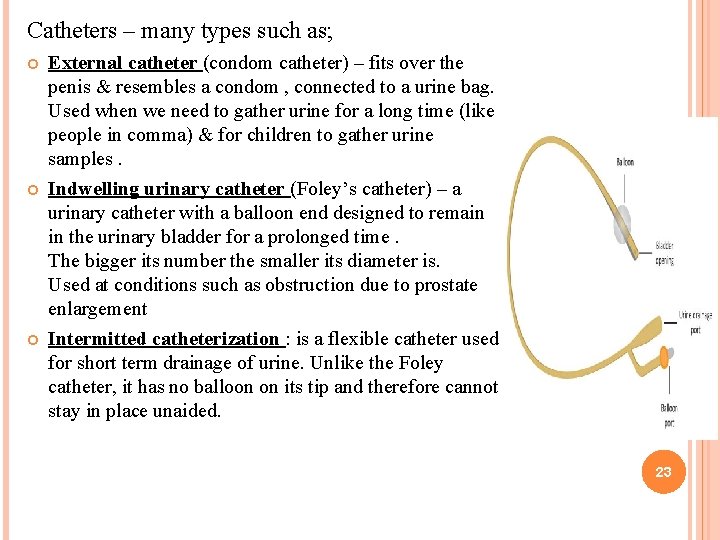 Catheters – many types such as; External catheter (condom catheter) – fits over the