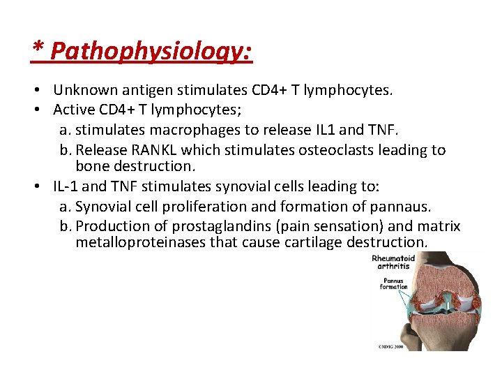 * Pathophysiology: • Unknown antigen stimulates CD 4+ T lymphocytes. • Active CD 4+