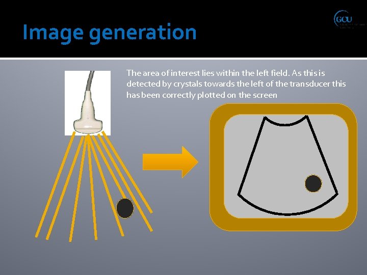 Image generation The area of interest lies within the left field. As this is