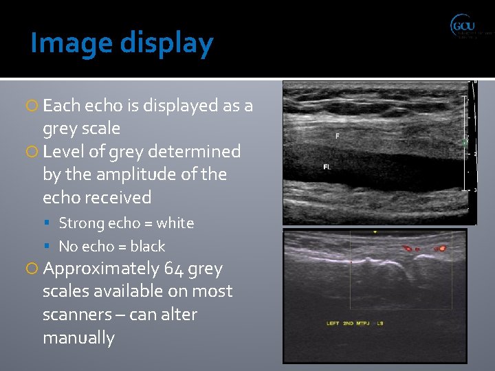 Image display Each echo is displayed as a grey scale Level of grey determined