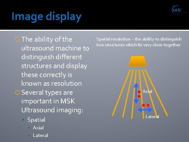 Image display The ability of the ultrasound machine to distinguish different structures and display