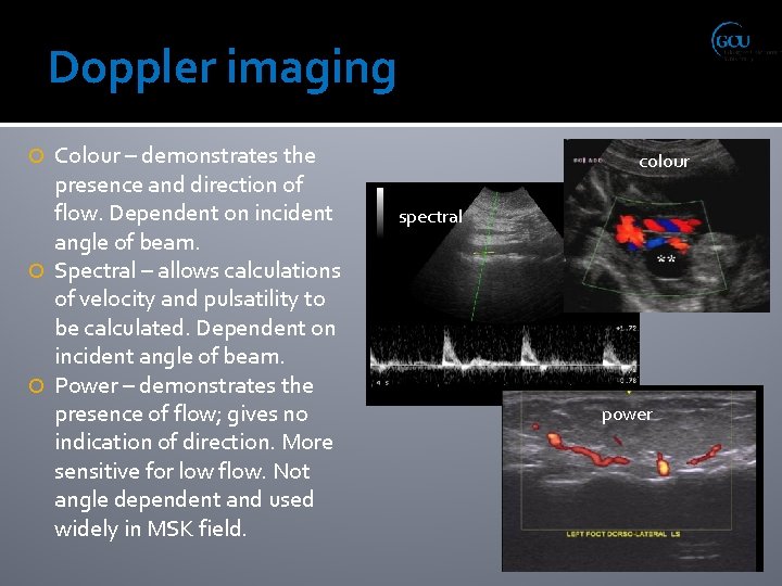 Doppler imaging Colour – demonstrates the presence and direction of flow. Dependent on incident