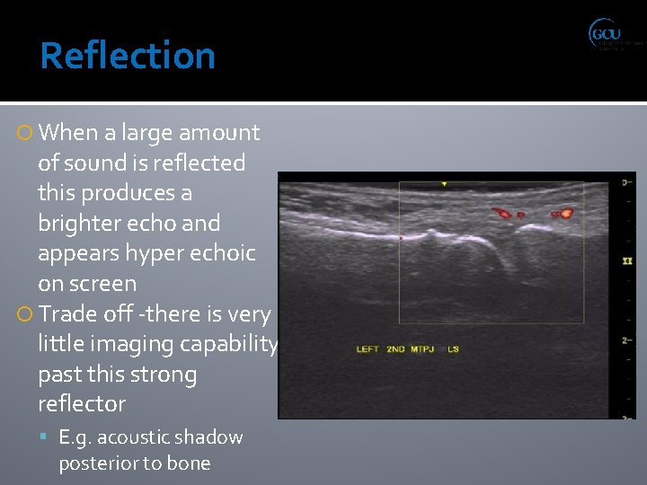 Reflection When a large amount of sound is reflected this produces a brighter echo