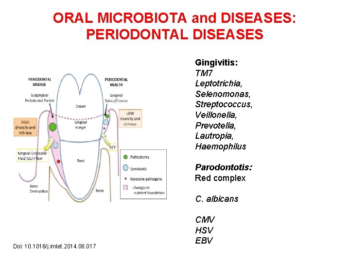 ORAL MICROBIOTA and DISEASES: PERIODONTAL DISEASES Gingivitis: TM 7 Leptotrichia, Selenomonas, Streptococcus, Veillonella, Prevotella,